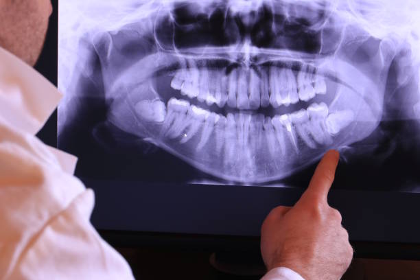 Best Weekend Emergency Dentist in Swede Heaven, WA